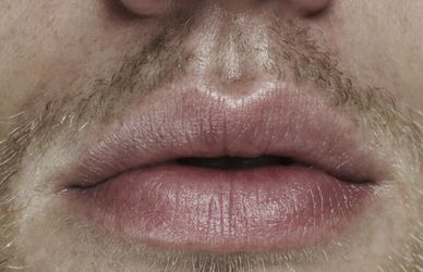 Labbra, non solo balsamo: 10 trattamenti da provare subito